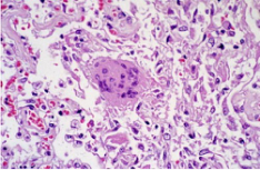 Preparation of pathological sections