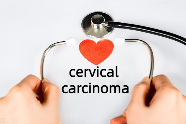 Comprehensive Strategy for Cervical Cancer Screening